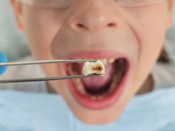 Best Emergency Denture Repair in Cary, IL